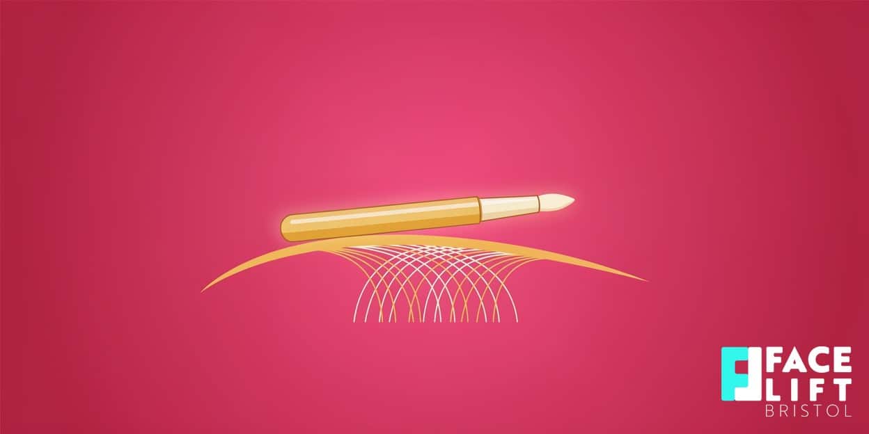 Flat-vector illustration of a fine needle-tipped roller passing over a stylised skin surface with new collagen fibres forming beneath, symbolising collagen induction