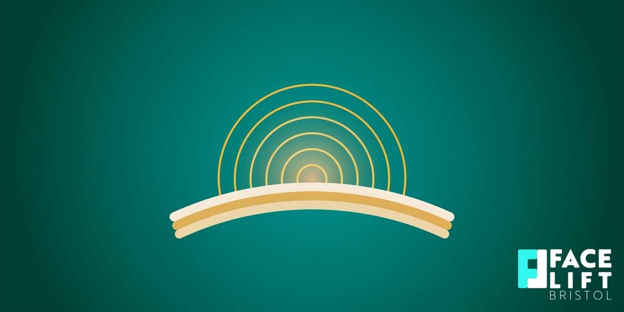 Flat-vector illustration of warm radiating energy waves diffusing into stylised skin layers, symbolising radiofrequency heating and collagen remodelling